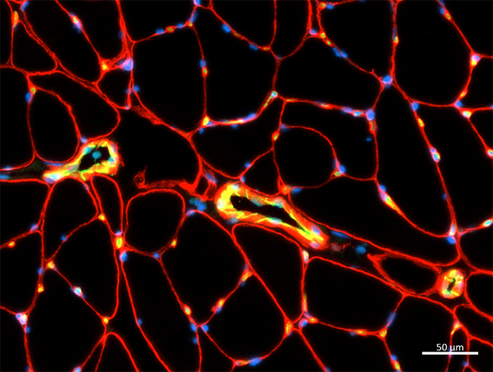 Histologische Analyse einer Hüftmuskel-Biopsie