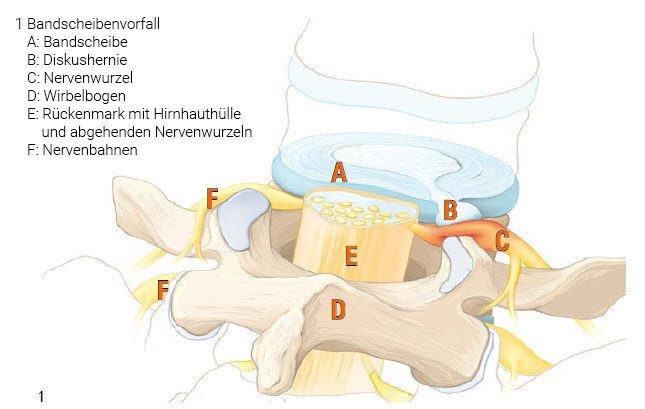 Anatomie Bandscheibe