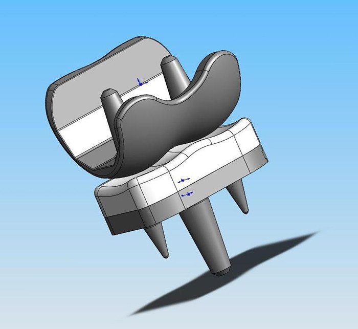 Computersimulation der Fingermittelgelenkprothese (CapFlex-PIP)