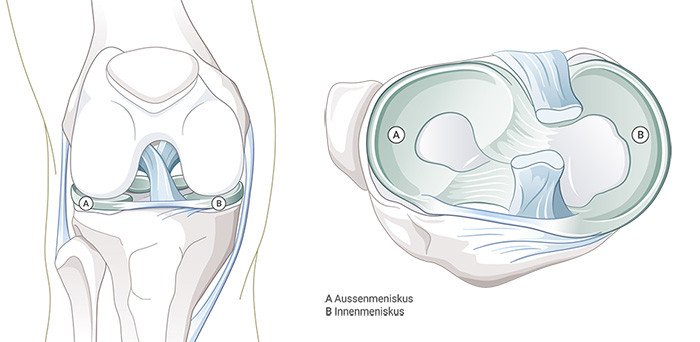 Illustration Anatomie Meniskus