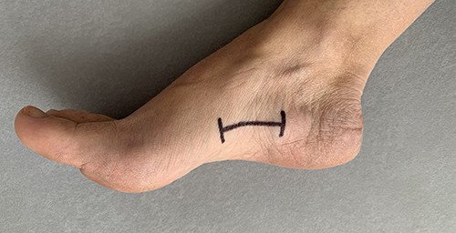 Fuss mit angezeichnneter Schnittstelle