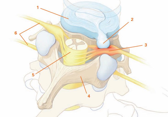 Anatomie Bandscheibe