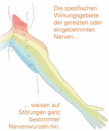 Schmerzausbreitung
