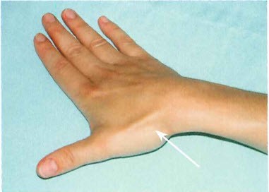 Schnell sich finger brechen kann wie den man Noroviren: Wie