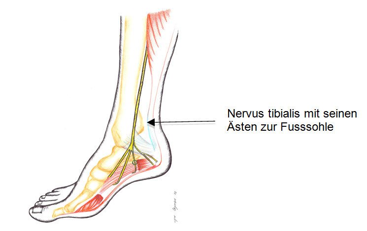 Nervus tibialis mit seinen Ästen zur Fusssohle