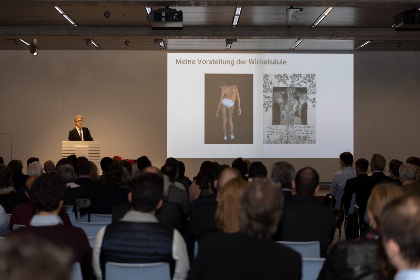 Dr. Dezsö J. Jeszenszky zeigt Bild eines Mädchens mit starker Skoliose