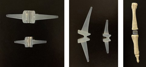 KeriFlex-Fingergelenksprothese aus 2 Perspektiven und am Modell