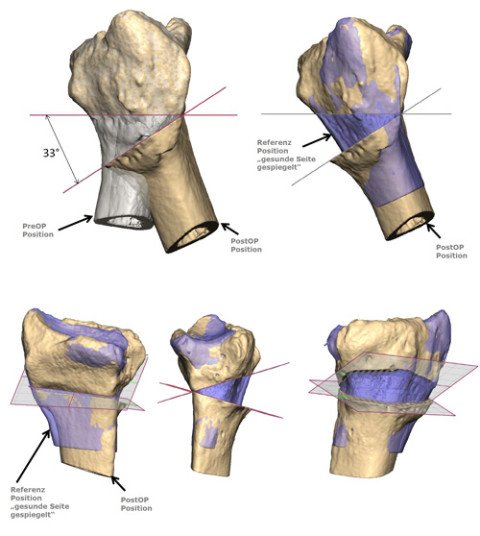 3D-Simulation am Computer Hand