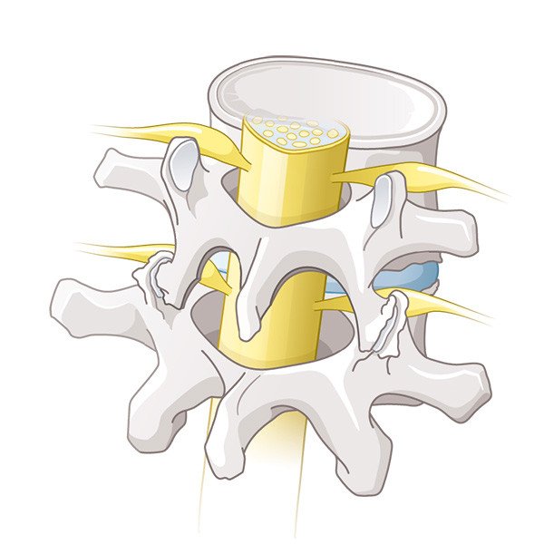 Dekompression Rückenmark und Nerven durch Spinalkanal
