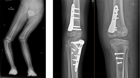Röntgenbilder von Maras Beinen.