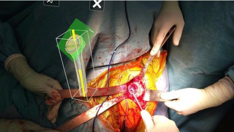 Mixed reality Anwendung im Rahmen einer Schulterendoprothesenimplantation