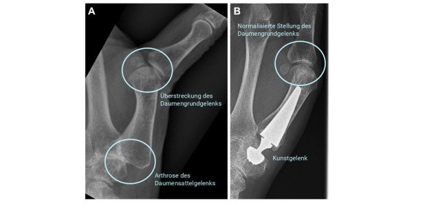 JB25: Handchirurgie