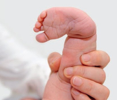 Klumpfuss beim Säugling