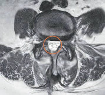 transversale Schichtung