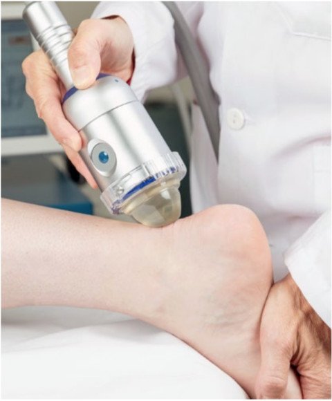 Stosswellenbehandlung mit dem Therapiekopf «EvoTrode»