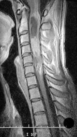 MRI mit Kontrastmittel