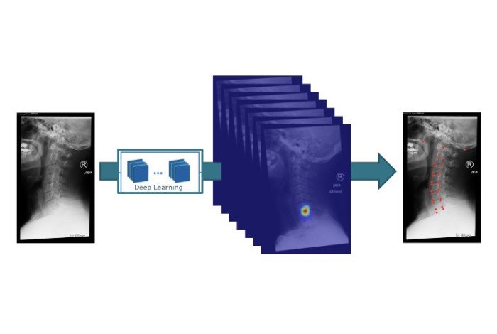 Wirbelsäulenparameter