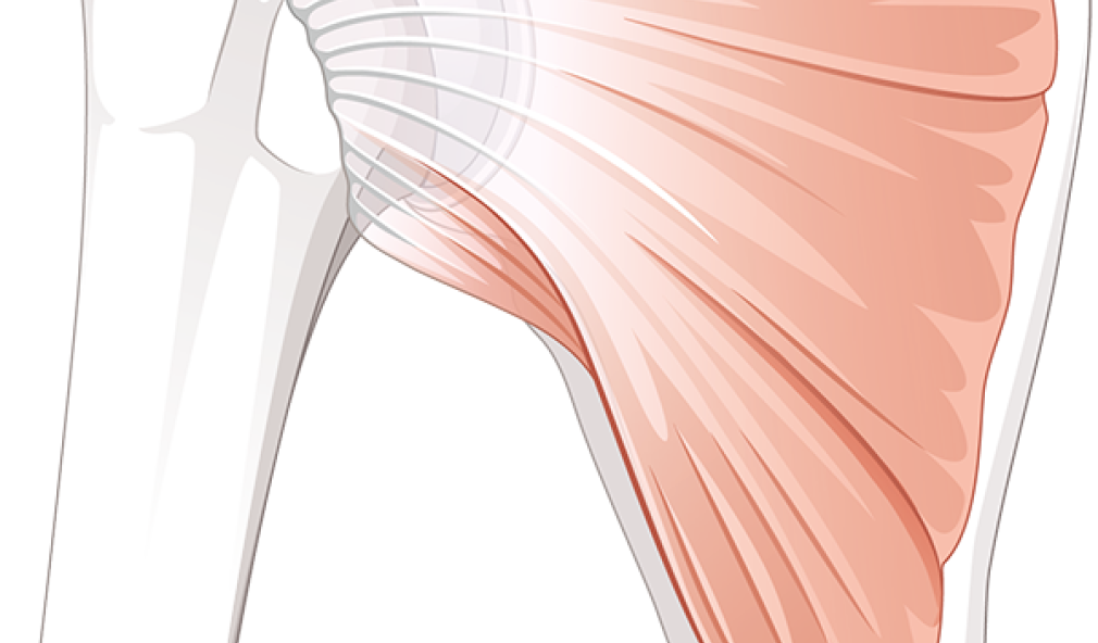 Illustration Anatomie einer Rotatorenmanschenttenruptur