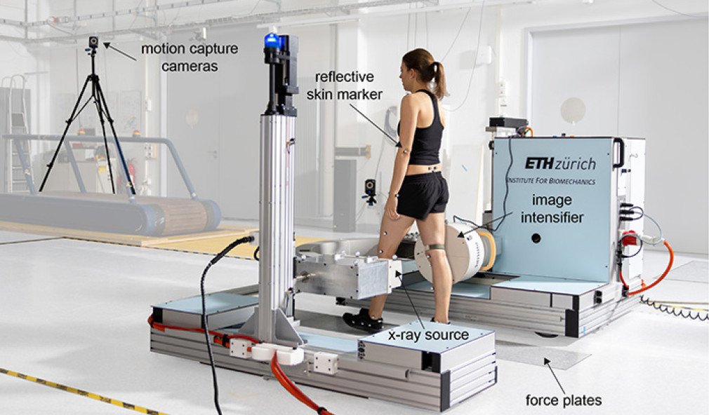 Bewegtes Fluoroskop beim Messen des Knies 