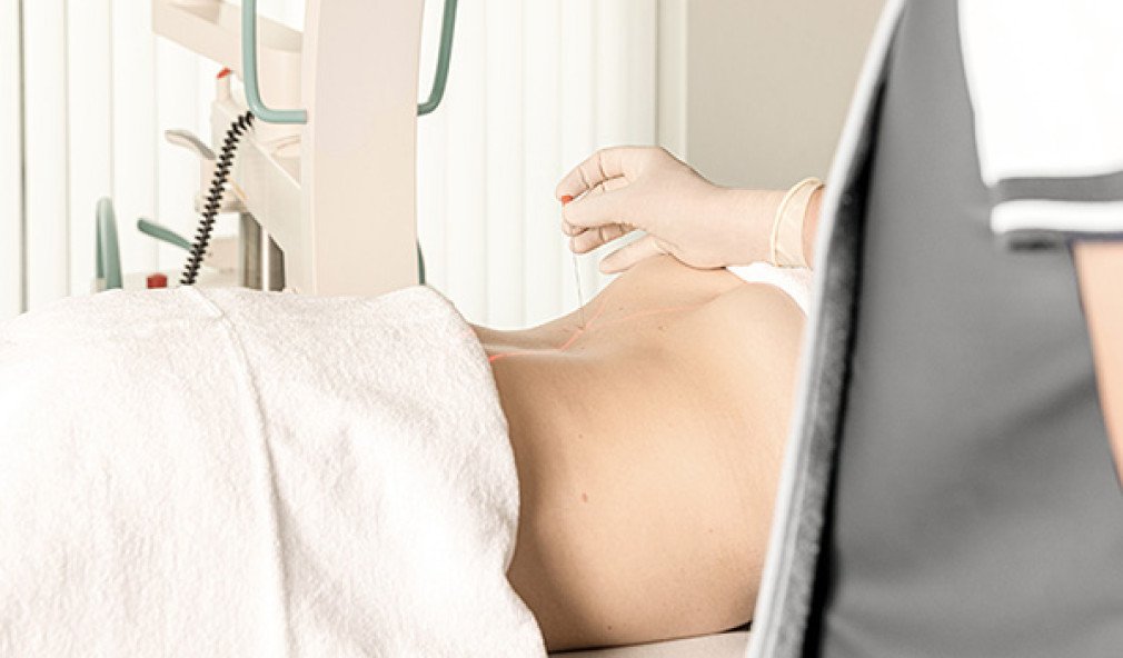 Infiltration am Rücken