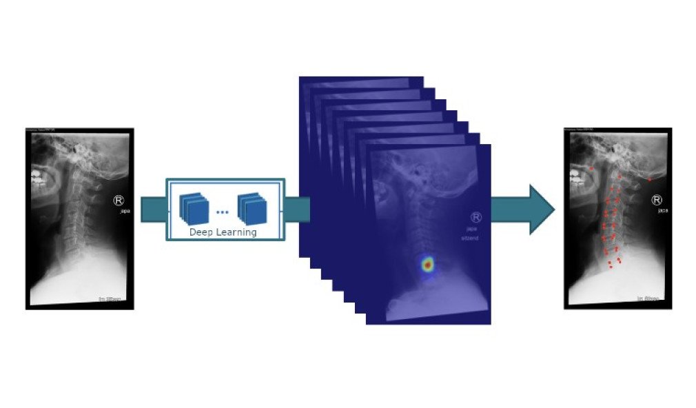 Wirbelsäulenparameter