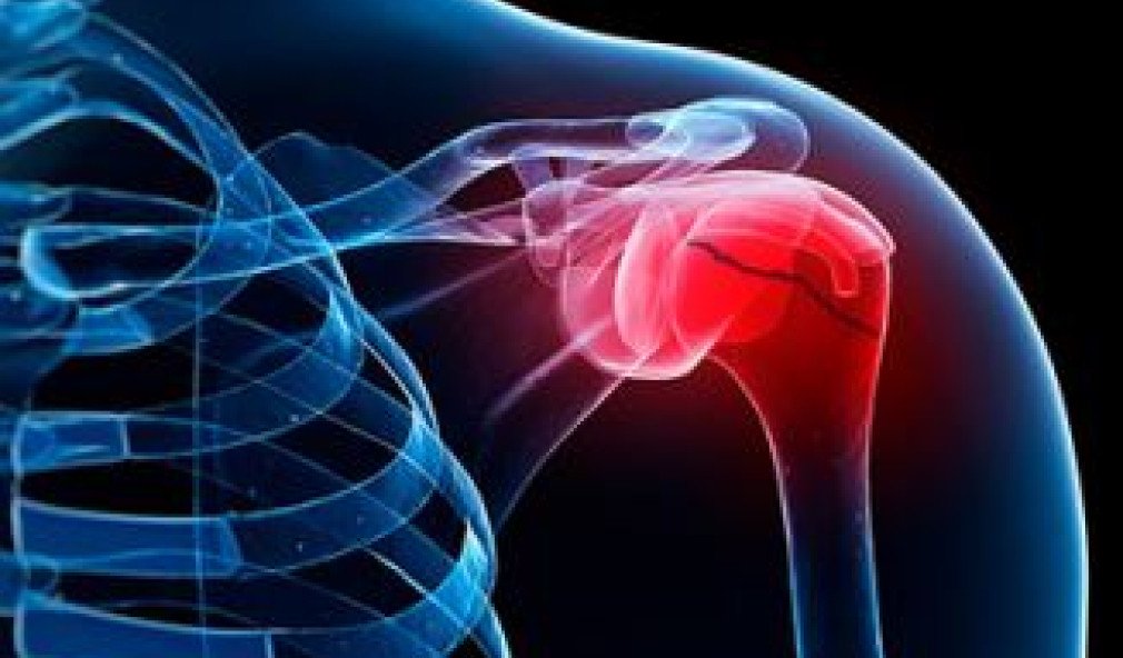 HSS-Charité-Schulthess Shoulder Conference 2024 TEASER