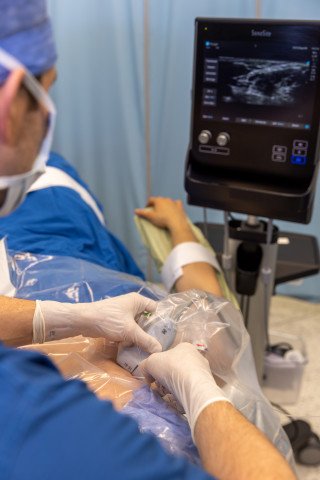 Ultraschallgesteuerte Regionalanästhesie in der Schulterchirurgie